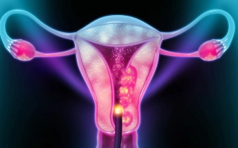 hysteroscopy