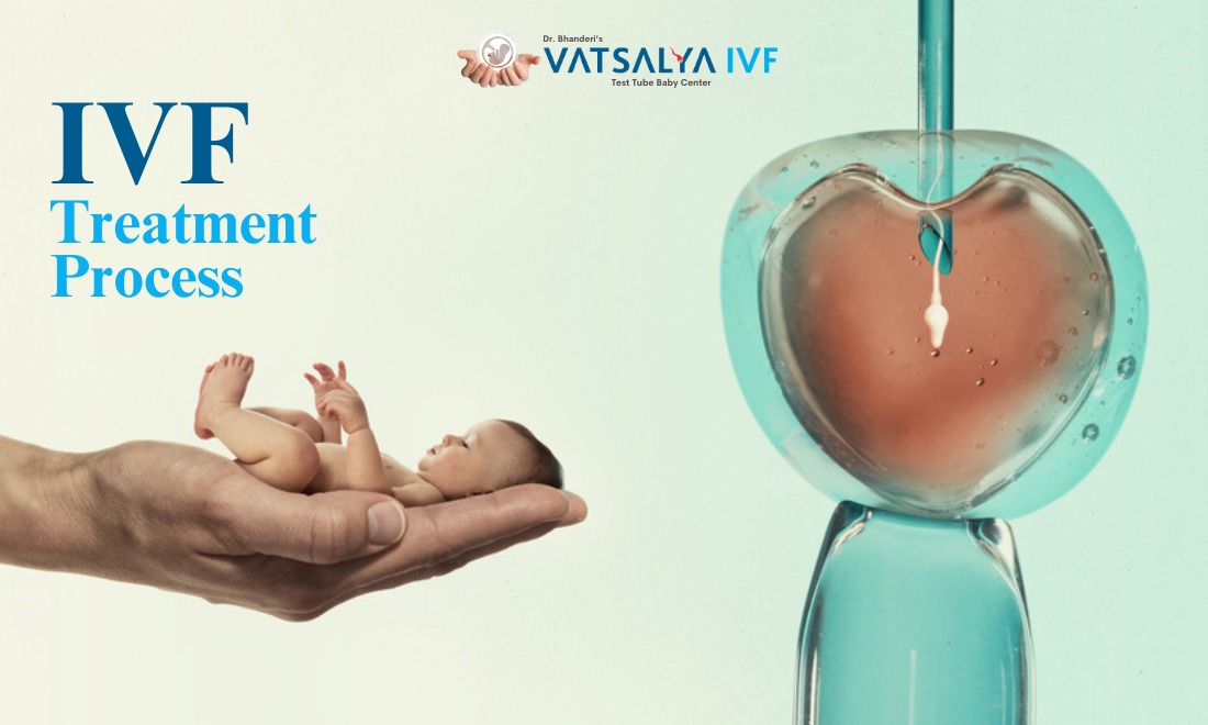 what to expect in the ivf treatment process